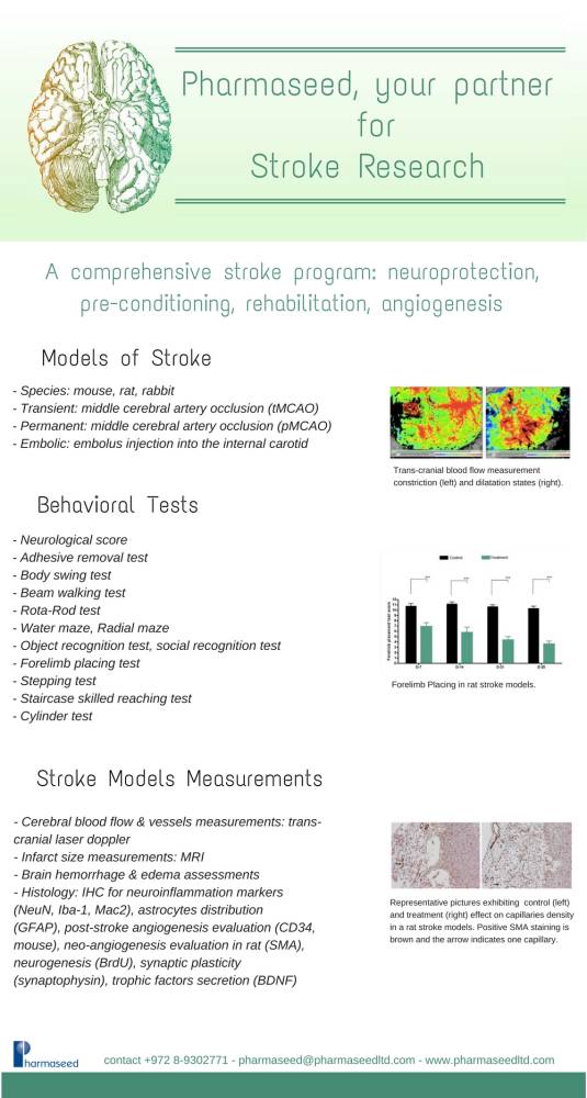 stroke-models